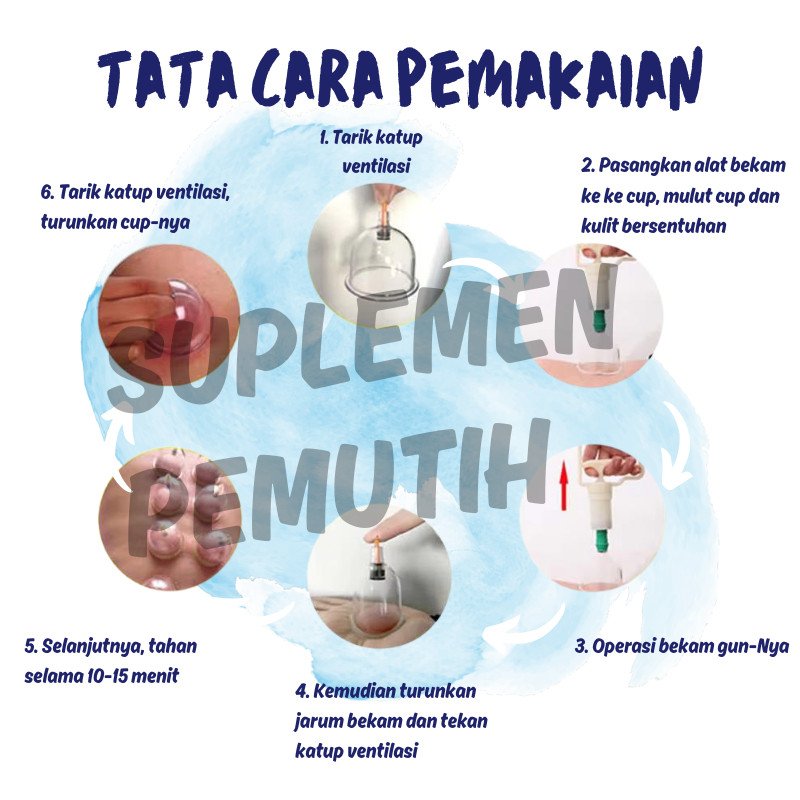 Alat Kop Angin Lengkap+Pen Bekam/Kop Angin isi 12/24/Alat Bekam Kop Angin Isi 12/24 - Gambar 6