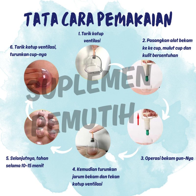 Kop DYKL 24 / 12 Alat Bekam DYKL isi 24 & 12 / Vacuum?Cupping?/?DYKL - Gambar 4