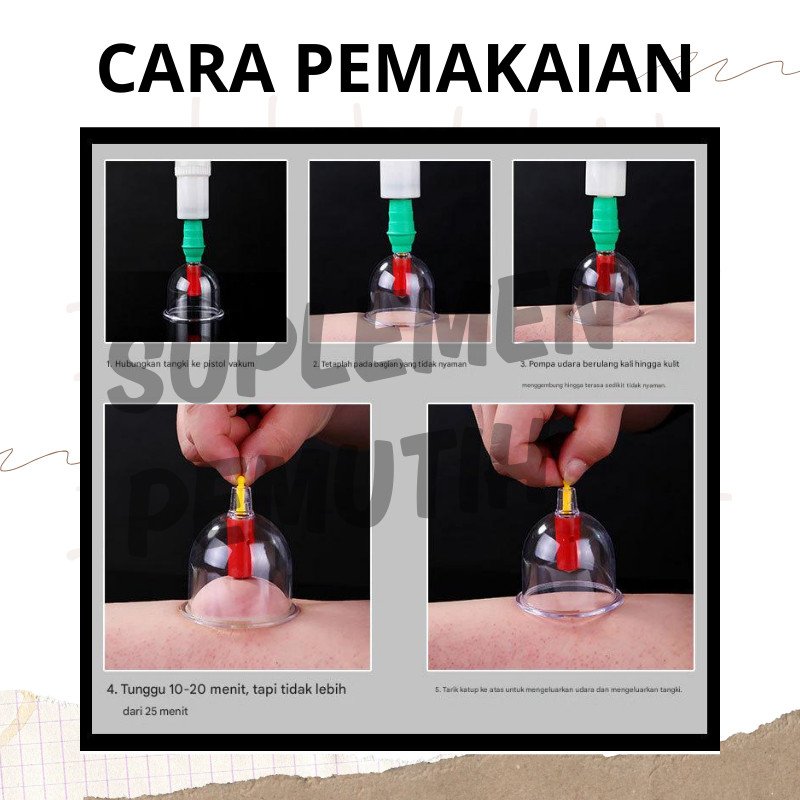 Kop DYKL 24 / 12 Alat Bekam DYKL isi 24 & 12 / Vacuum?Cupping?/?DYKL - Gambar 2